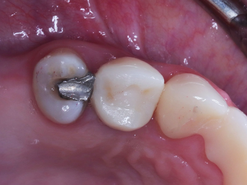 After Image