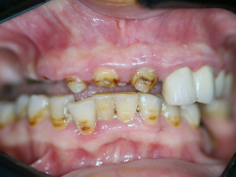 Before Image