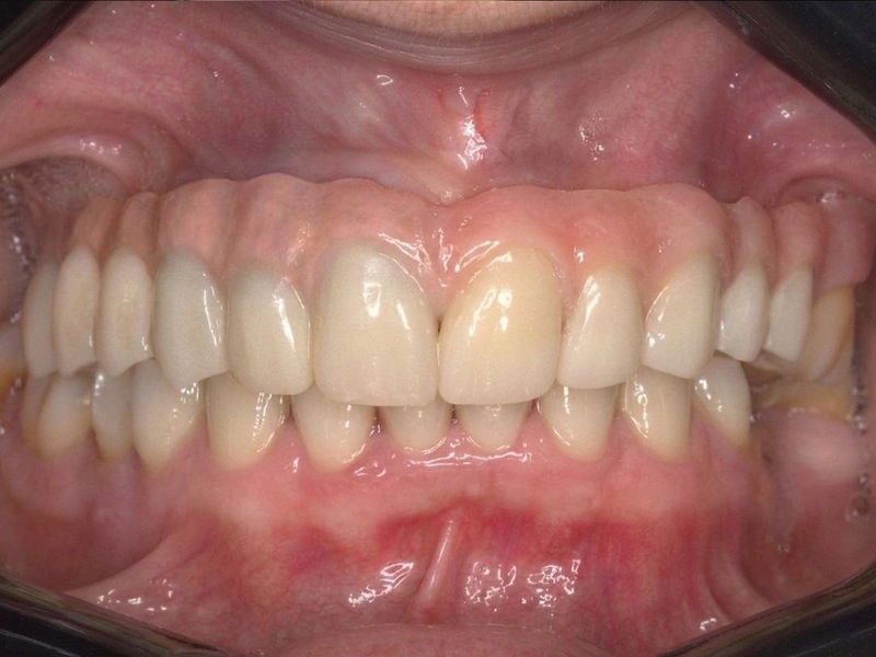 After Image