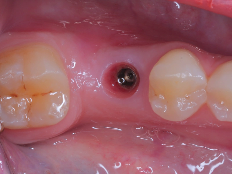 Before Image