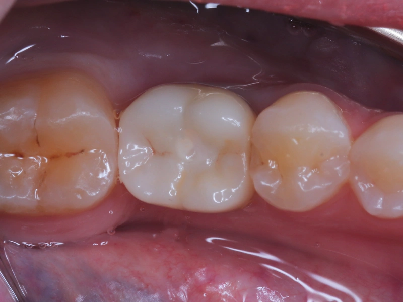 After Image