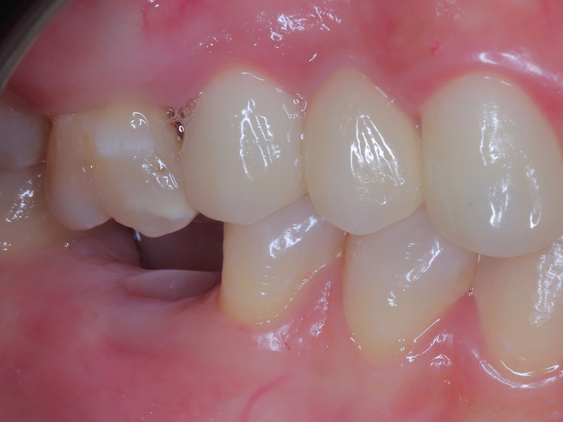 Before Image