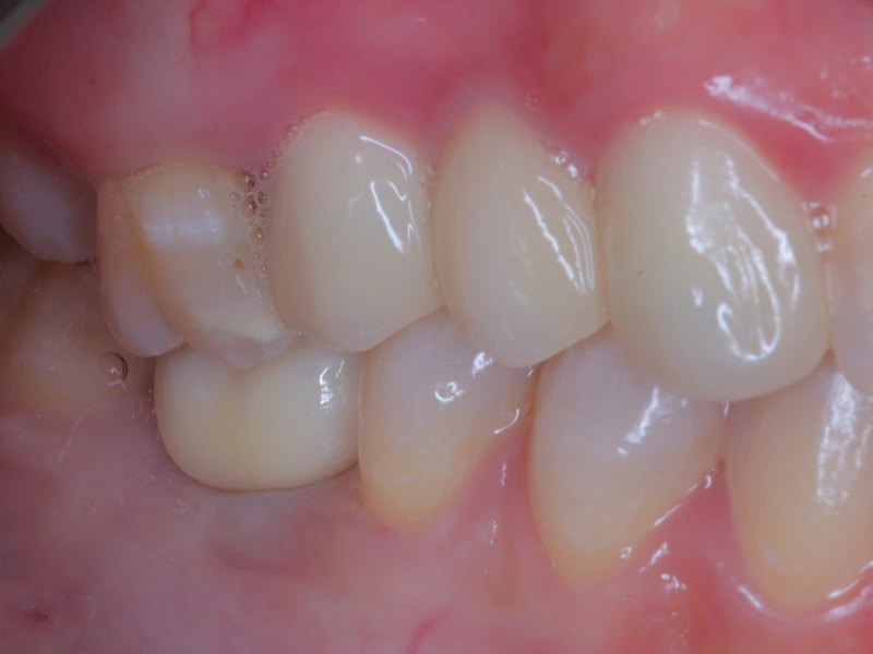 After Image
