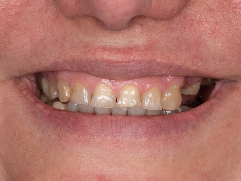 Before Image