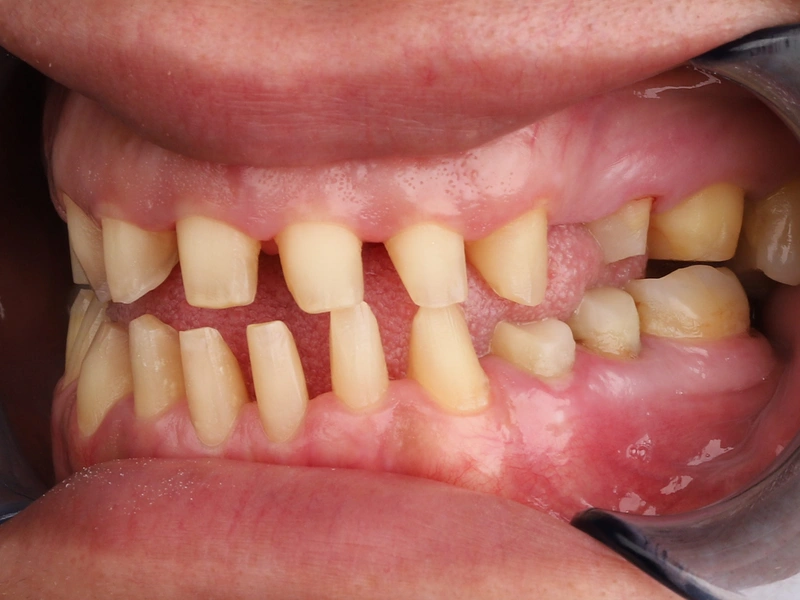 Before Image