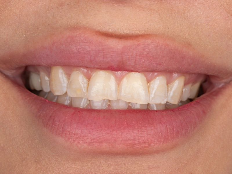 Before Image