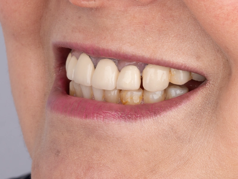 Before Image