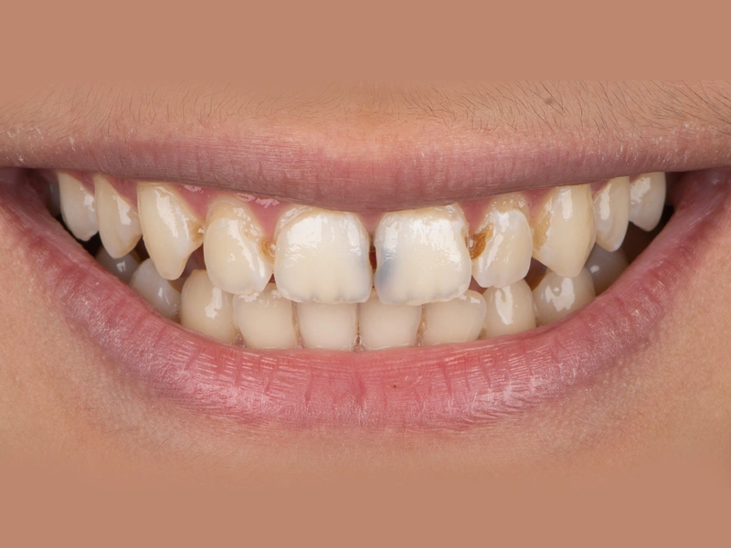 Before Image
