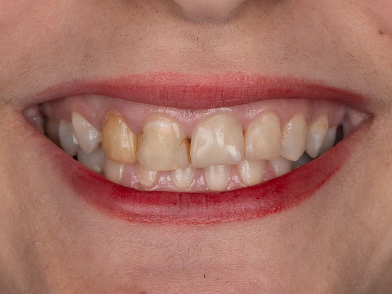 Before Image