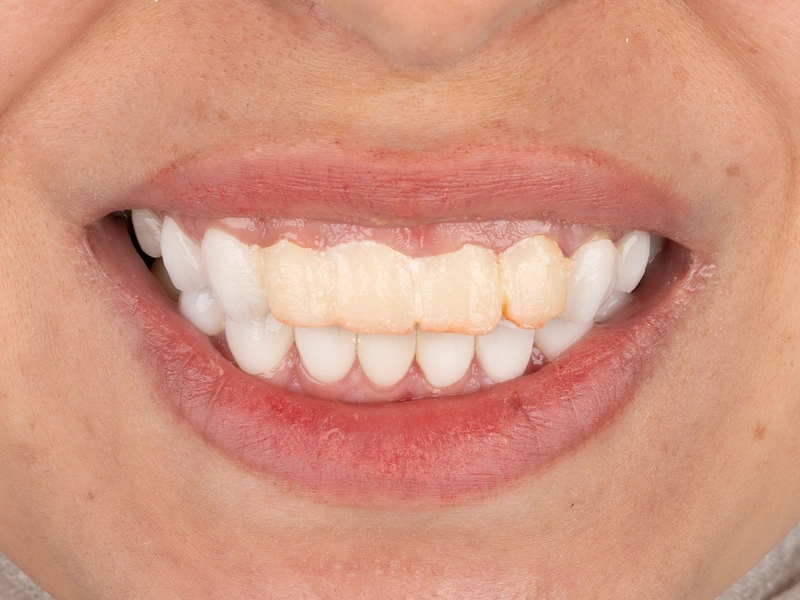 Before Image