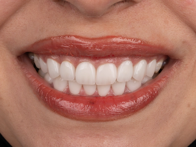 After Image