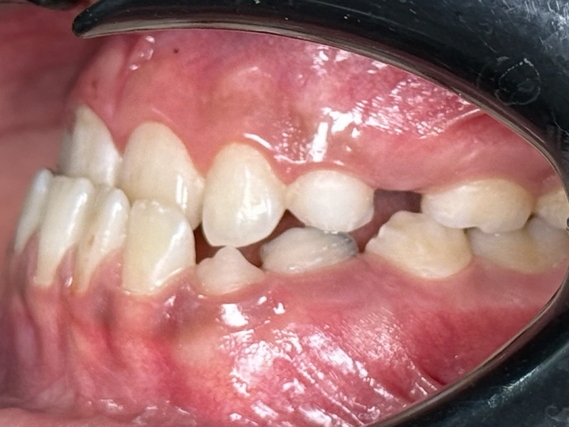 Before Image