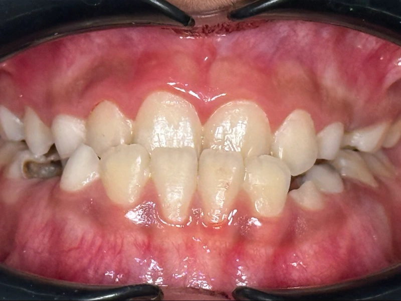 Before Image