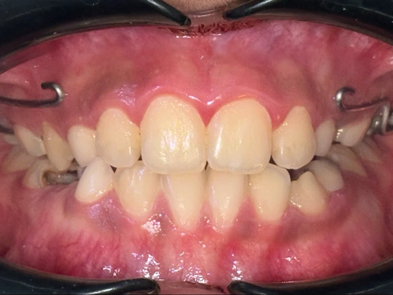 After Image