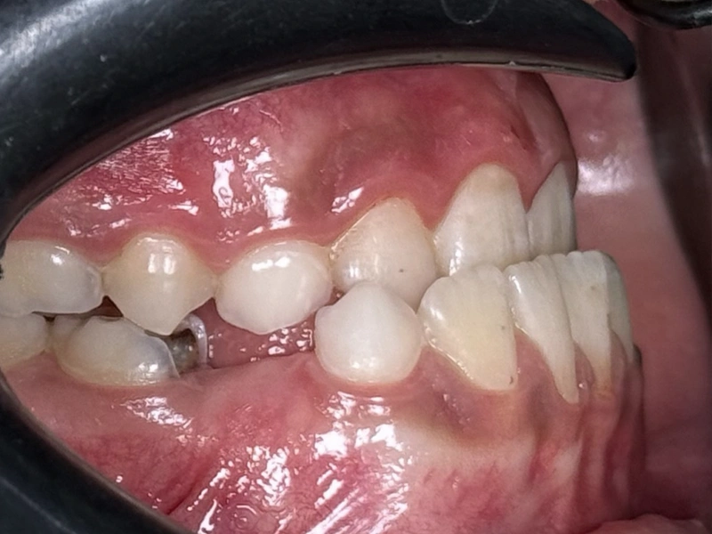 Before Image