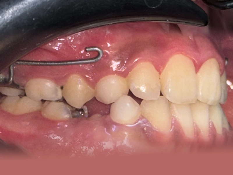After Image