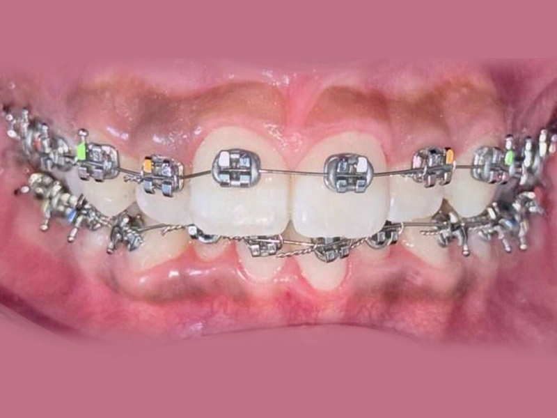 Before Image
