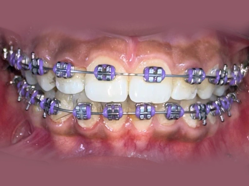 After Image