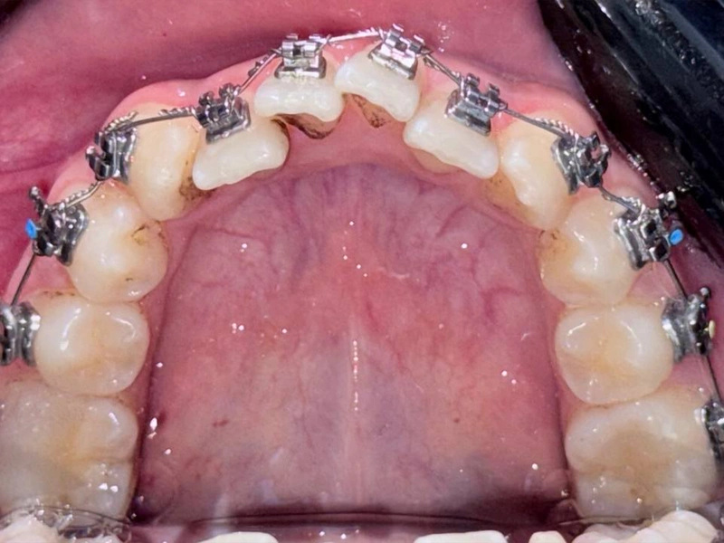 Before Image