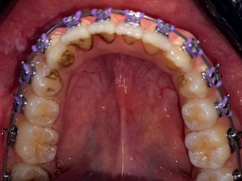 After Image