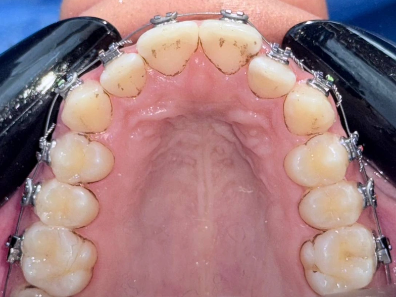 Before Image