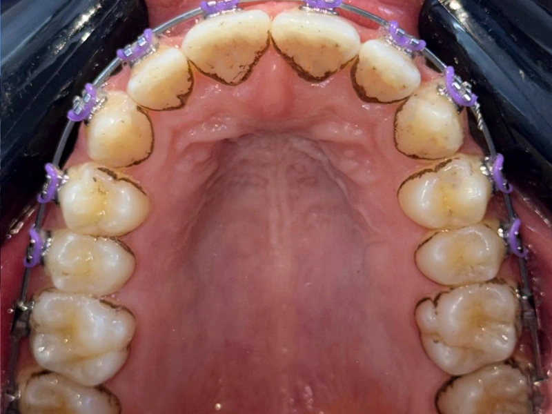 After Image