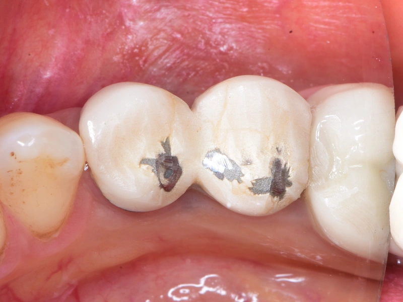 Before Image