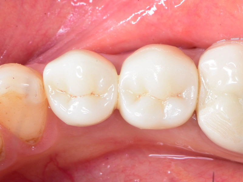 After Image