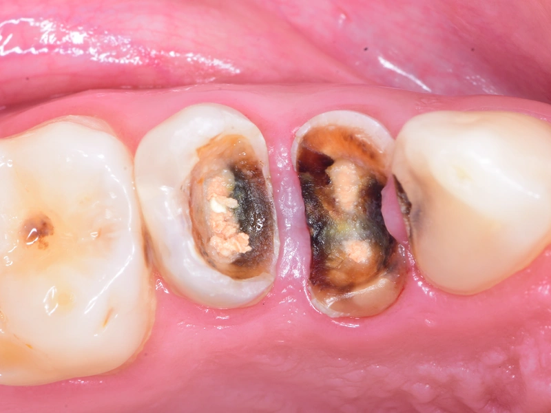 Before Image