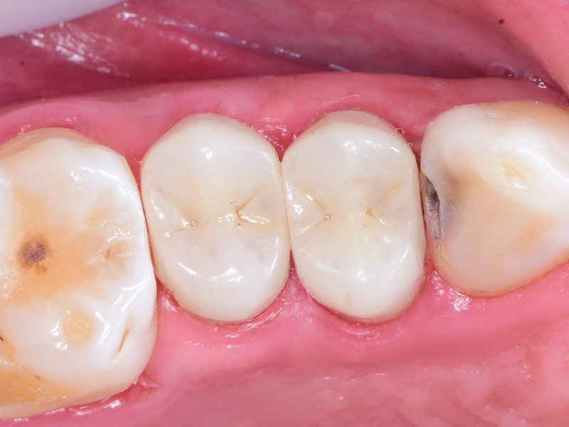 After Image
