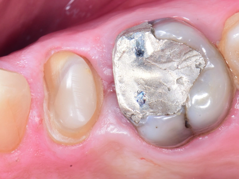 Before Image