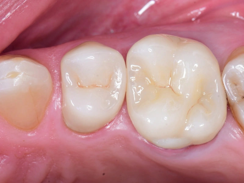 After Image