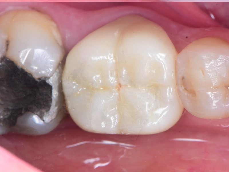 After Image