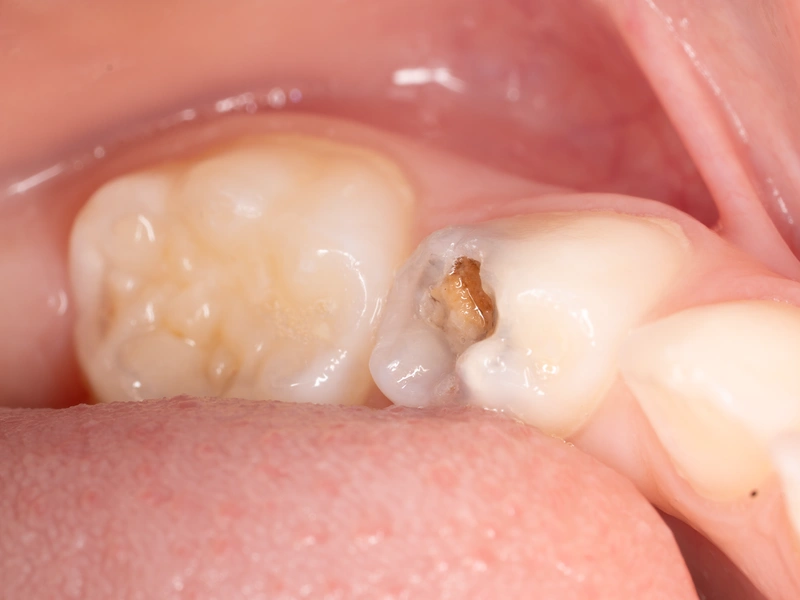 Before Image