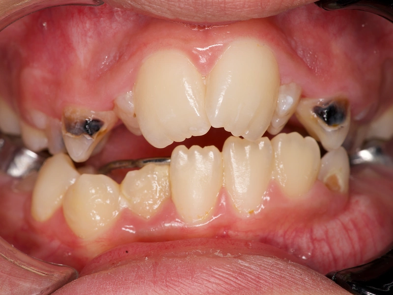 Before Image
