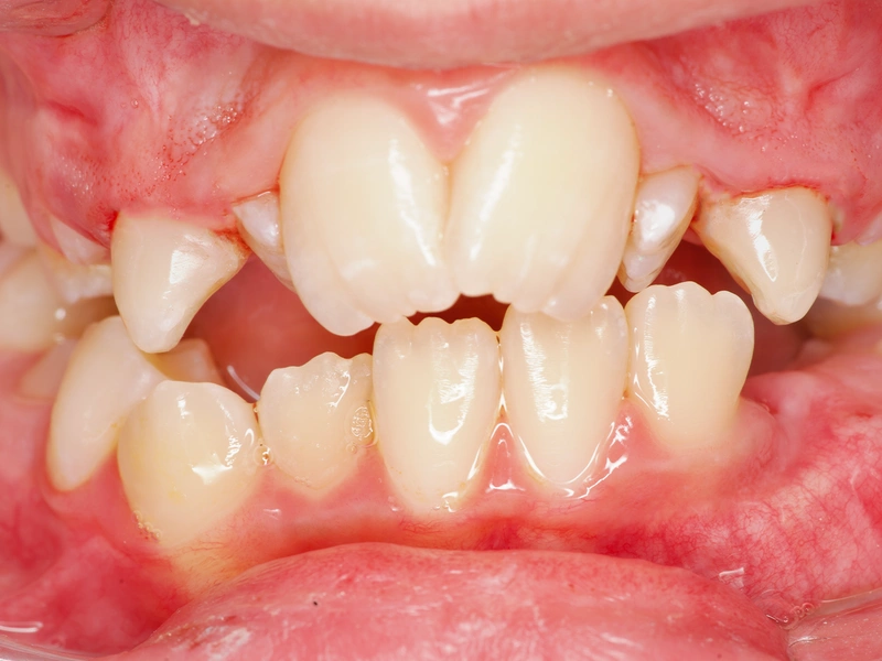After Image