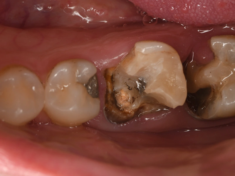 Before Image