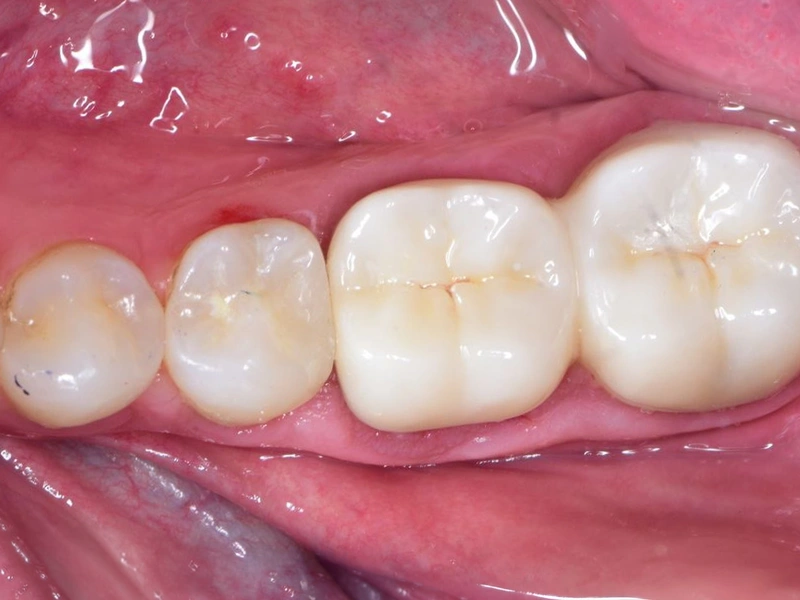 After Image