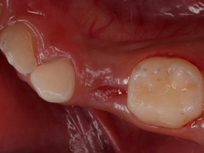 Before Image
