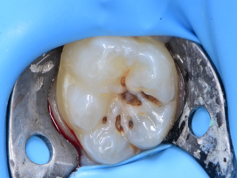 Before Image