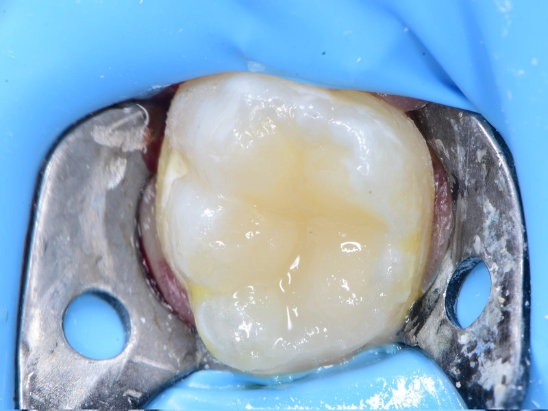 After Image