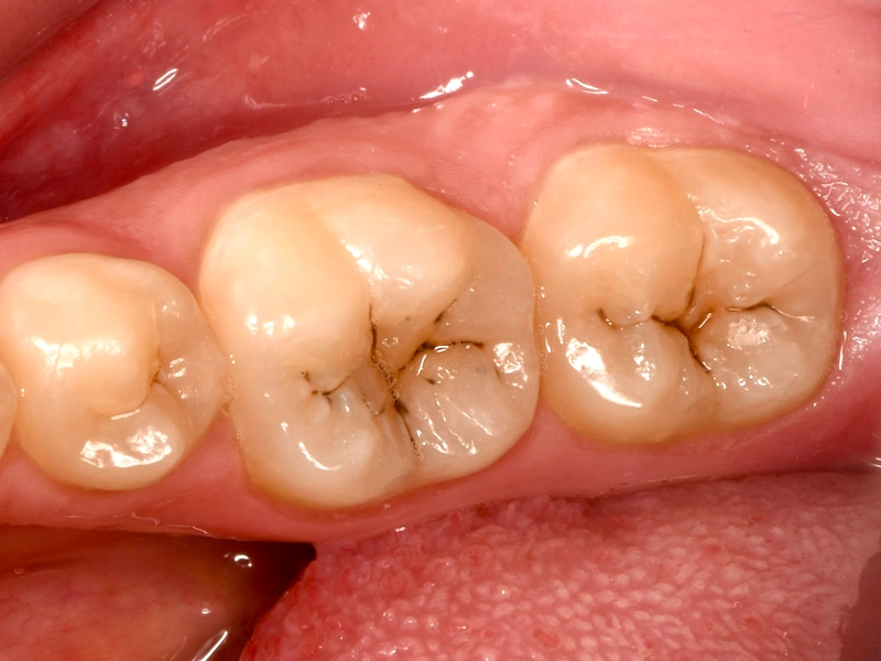 Before Image