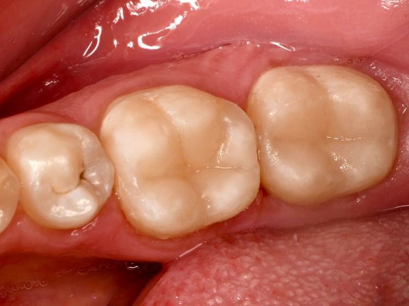 After Image