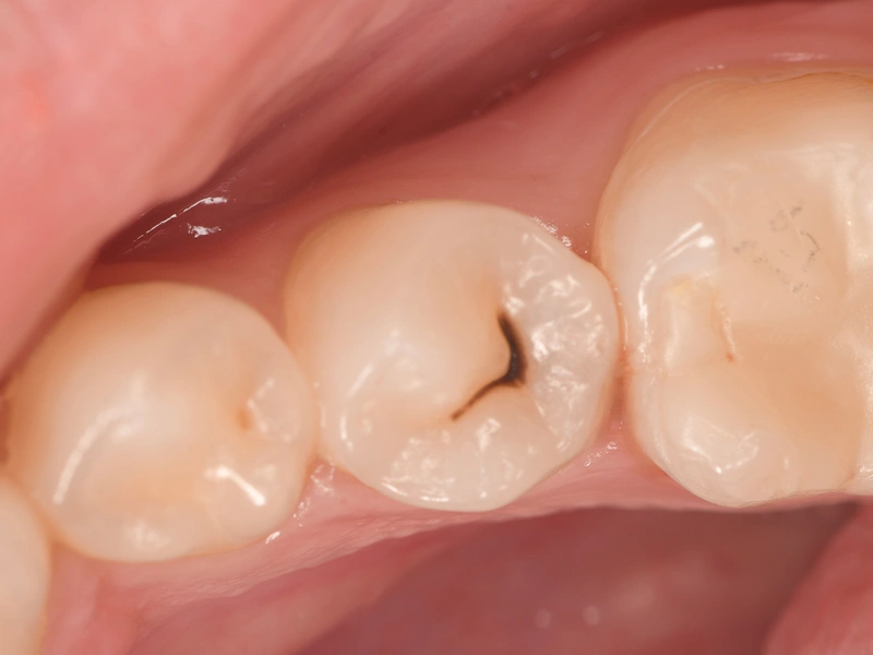 Before Image