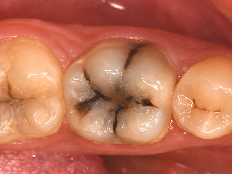 Before Image
