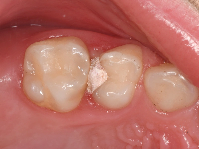 Before Image