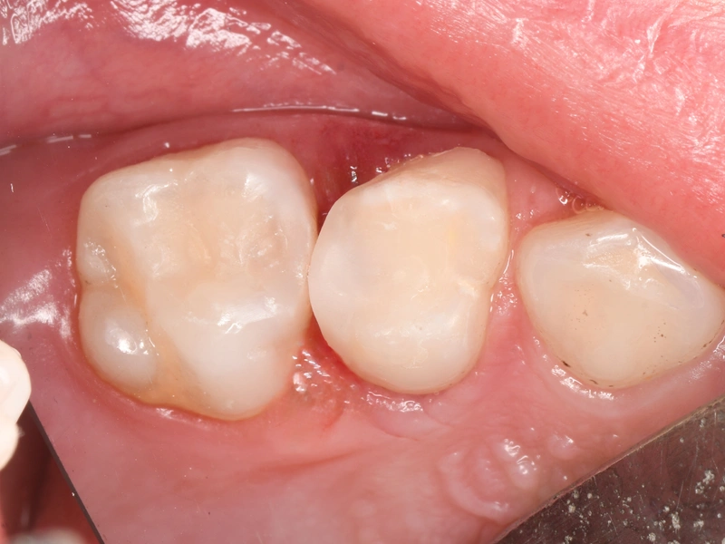 After Image