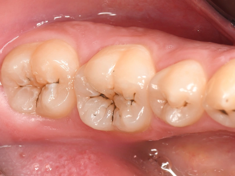 Before Image