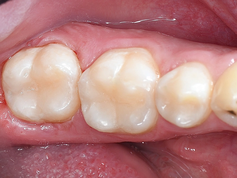 After Image