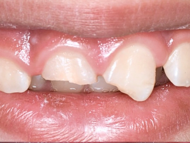 Before Image